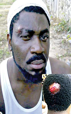 STAR ACTOR,AYO BADMUS ALMOST BEATEN TO DEATH BY OSHODI LG CHAIRMAN’ THUGS