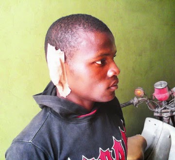 How Angry Man Bite Off Step Son’s Ear (Photo)