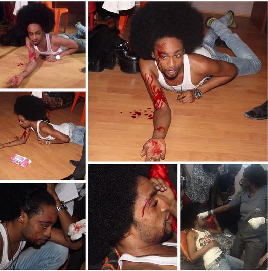 Denrele Edun Discharged from Hospital After Minor Accident