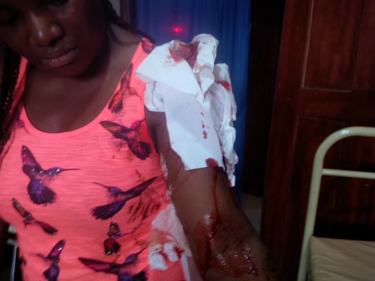 Egor Efiok Wounded In Car Crash (Photos)