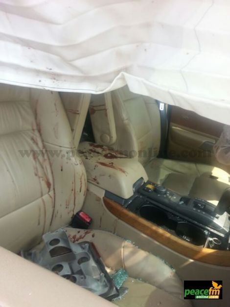 GHANA ACTRESS, NANA AMA RECUPERATES AFTER SERIOUS ACCIDENT [PICTURES]