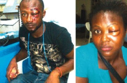 MUST READ!!! Rise of police brutality: 8-month pregnant lady beaten, loses baby