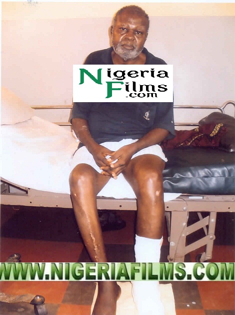 E-X-C-L-U-S-I-V-E: Breaking News; Veteran Actor, Pete Eneh Passes On After Losing Leg To Amputation