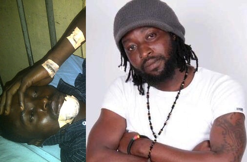 I Didn’t Stab DJ Kelvin, But My Friend Did–Skaliey Mental Reacts