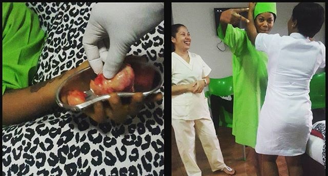 Toyin Lawani Survives Fibroid Surgery