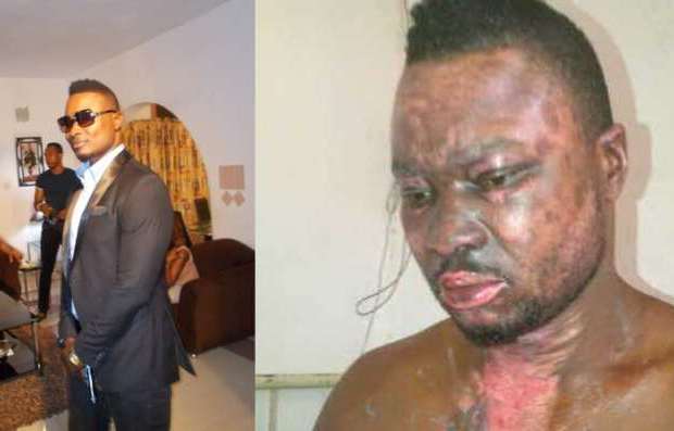 Nollywood Actor Von Apochi Set To Resume Acting After Fire Accident (Photo)