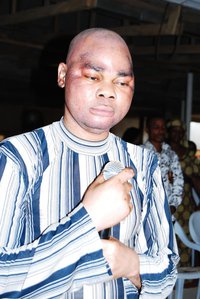 Pastor Ajanaku’s Complexion: Bleaching Or Vitiligo?