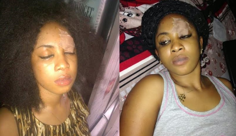 2015 Elections: Actress Robbed, Stabbed By Political Thugs In Lagos (Photo)