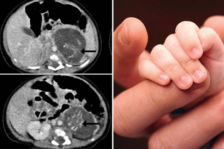 Mysterious : Newly born baby girl ‘PREGNANT’ with twins