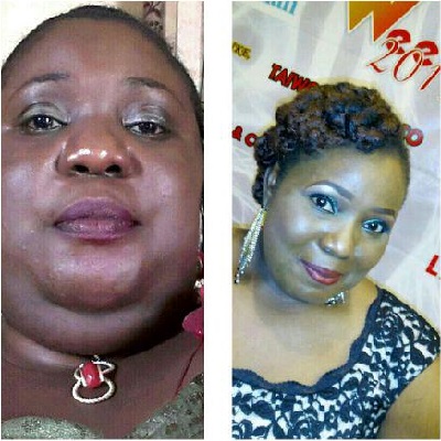 Before & After: Lepacious Bose Losing Weight so Fast