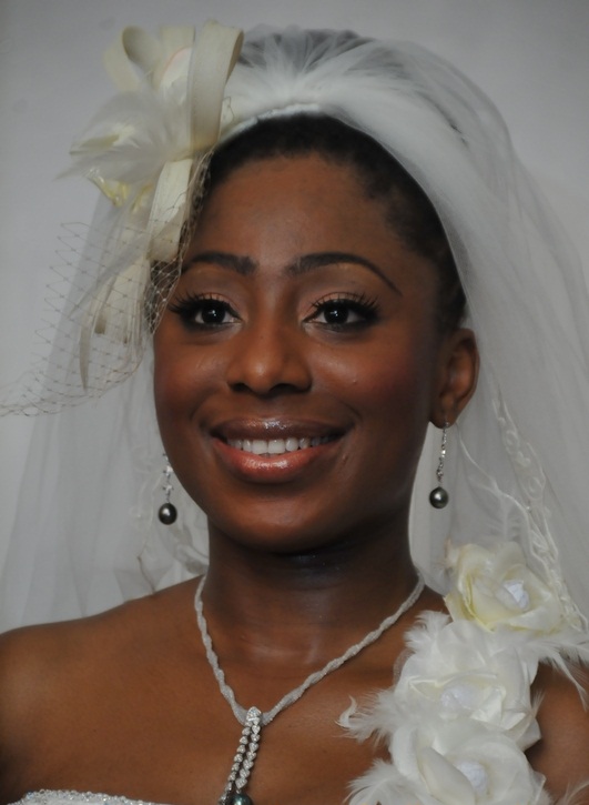 Plastic Surgery On Dakore’s Nose?