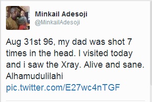 “My Dad Was Shot In The Head 7 Times, And He’s Still Alive” — Man Shares His Testimony Online..Photo