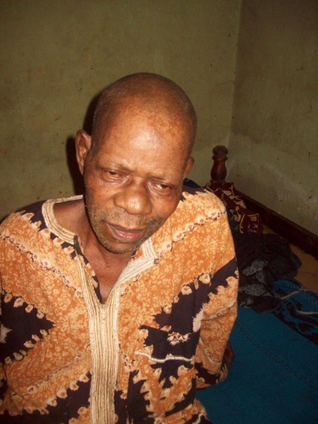 Popular Comic Actor, Dento Hit With Stroke… Needs N250,000 To Stand Again