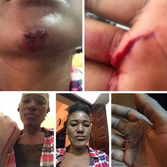 Nollywood Actress, Judith Audu sustains major injuries (Pictures)