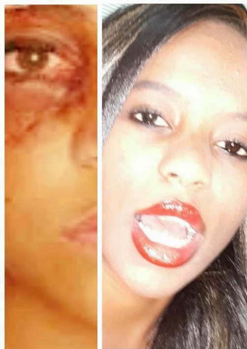 Kenyan TV Girl Assaulted By Lover (Viewers Discretion Advised)