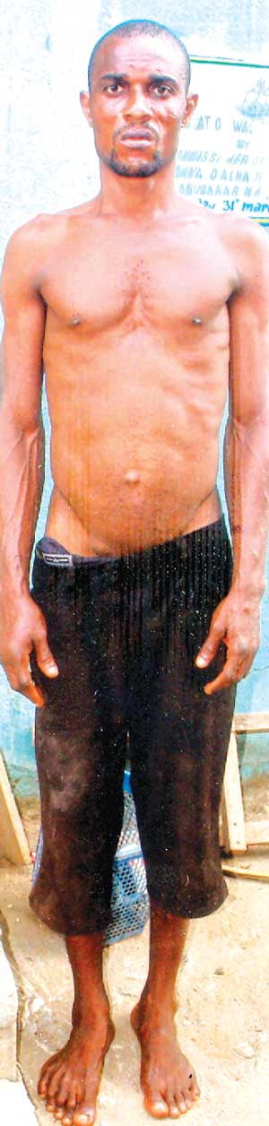 Man who burnt wife with hot iron opens up, as emotions pour in for burnt wife ( A MUST-READ )