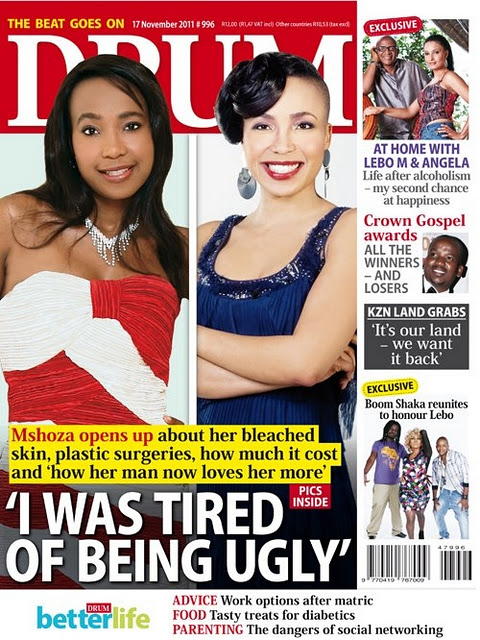 South African Star Bleaches Skin because she was tired of being ugly!