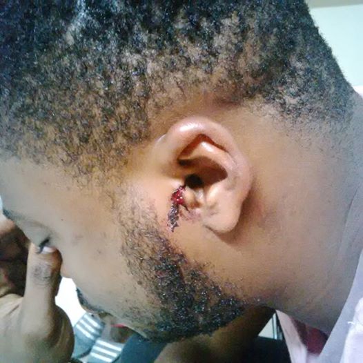 How Abuja-Based Musician Was Beaten By Soldiers