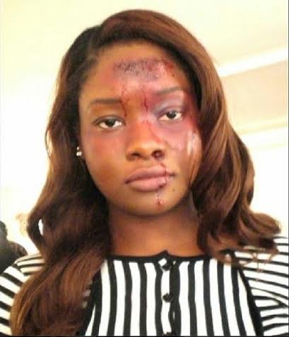 OMG! Who Beat OAP toolz up?