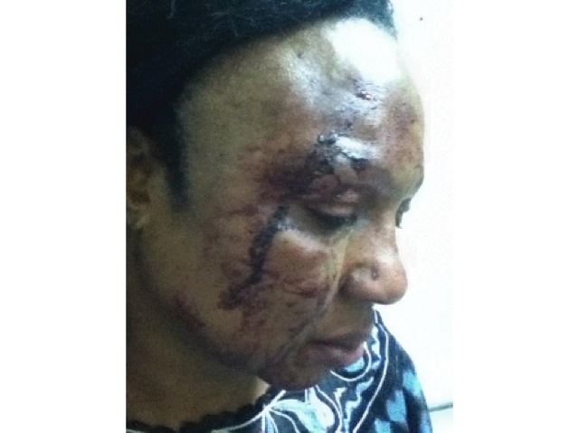 Nigerian High Commissioner’s Official (Dr Wigwe) Denies Wife Battering Allegations