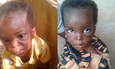 Corper Discovers Little Witch Who is Passing Through Hell in Anambra State